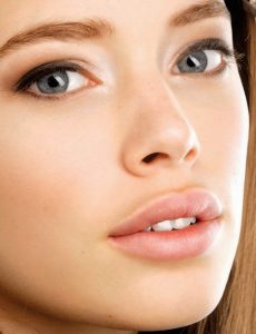 juvederm-fillers