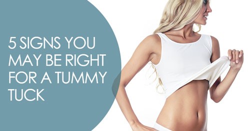 Finding the Right Tummy Tuck Option for You
