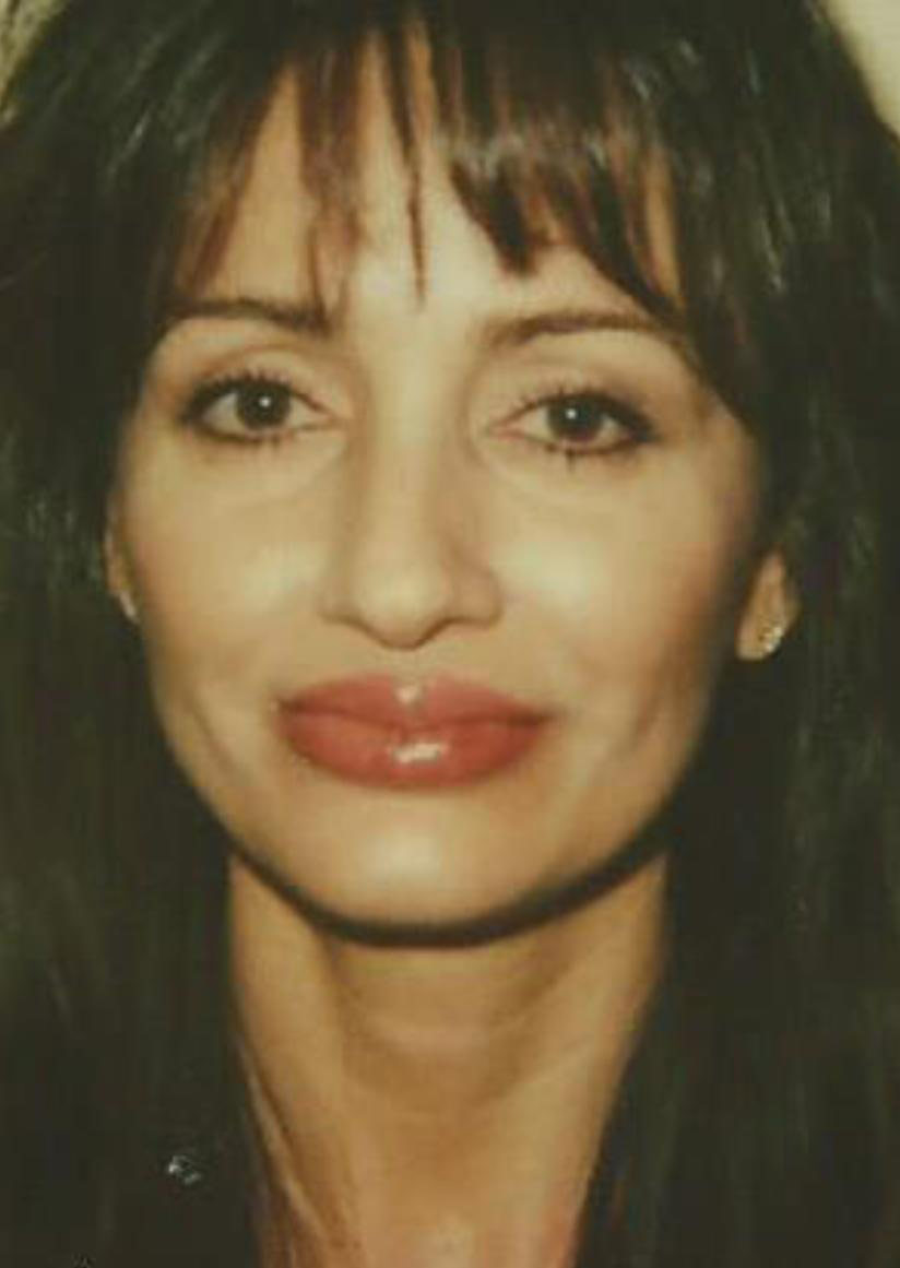 Derma fat Lip Augmentation Before & After Patient #1541