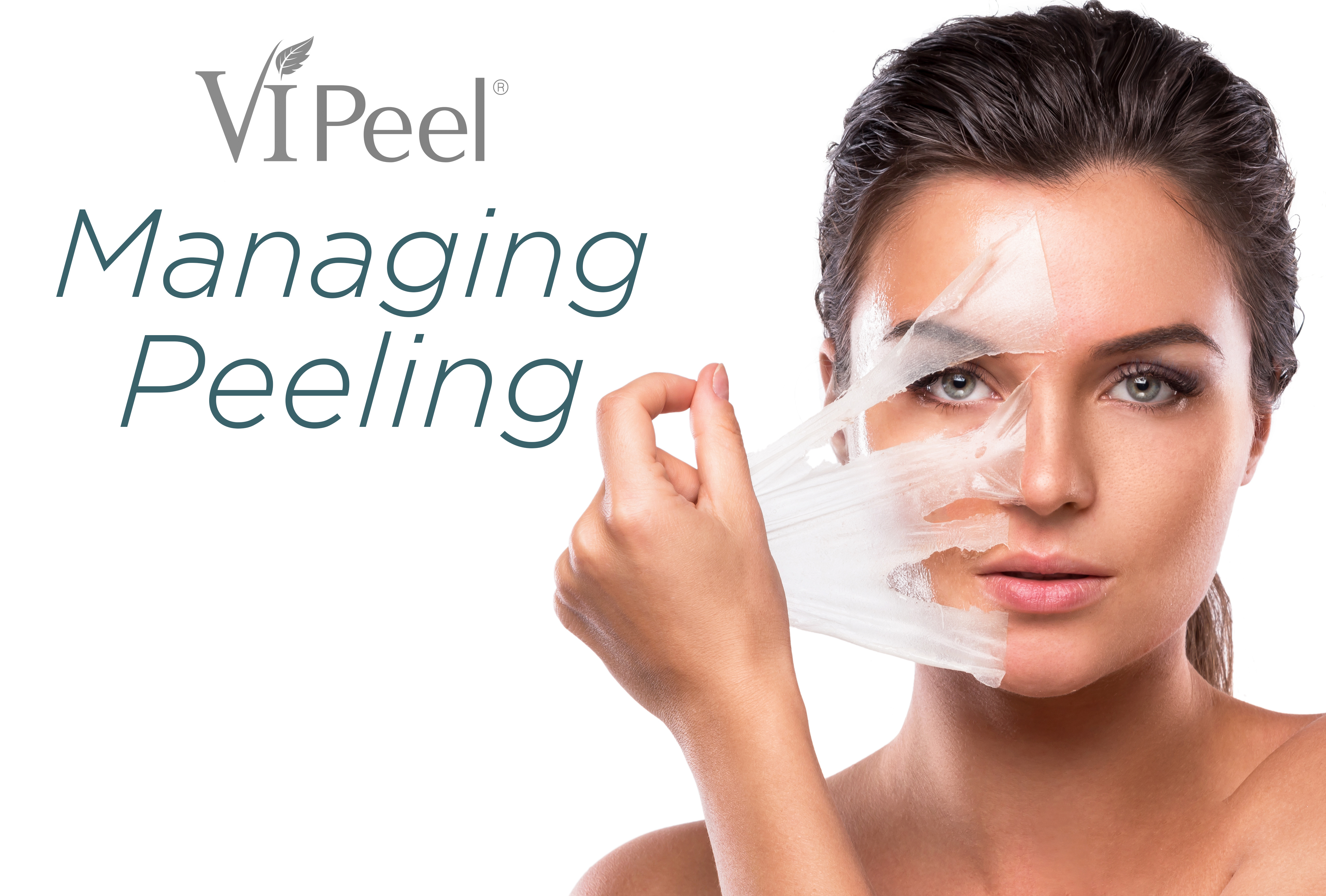 Vi Peel Manage Peeling