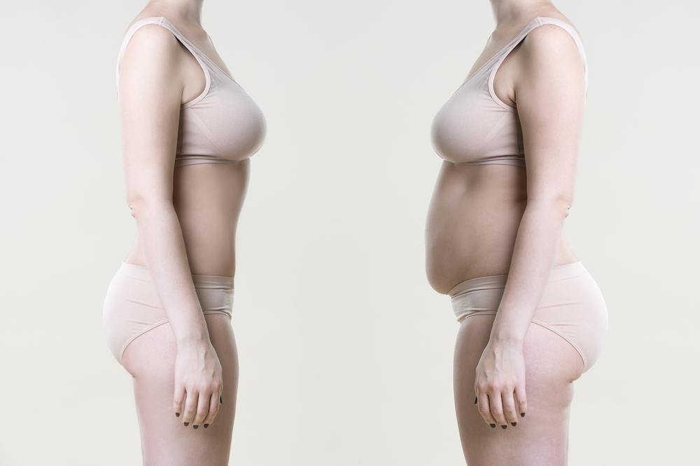 How To Prepare Your Patient For Liposuction Recovery